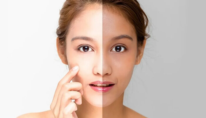 Rahasia Kulit Cerah Merata: 5 Bahan Aktif Pencerah untuk Semua Jenis Kulit