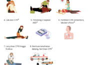 Cara Melakukan CPR yang Benar dan Efektif untuk Keselamatan Jiwa
