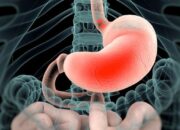 Rahasia Sembuhkan Asam Lambung dengan Alami, Nomor 4 Disalahpahami