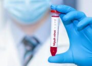 Kemenkes Minta Fasilitas Kesehatan Deteksi Virus Nipah