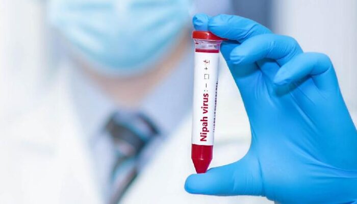 Kemenkes Minta Fasilitas Kesehatan Deteksi Virus Nipah